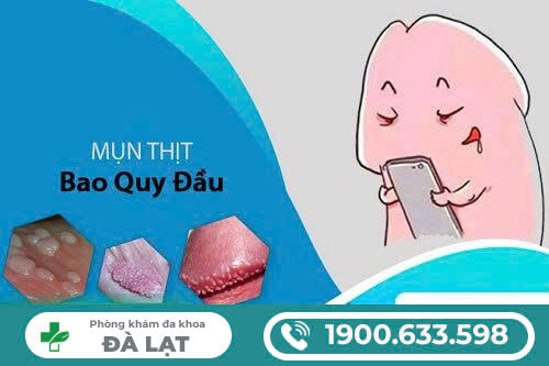 Hình ảnh minh họa